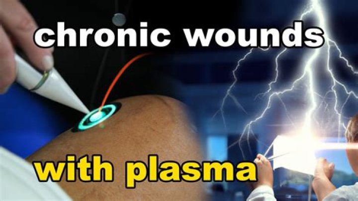 Can you touch plasma?