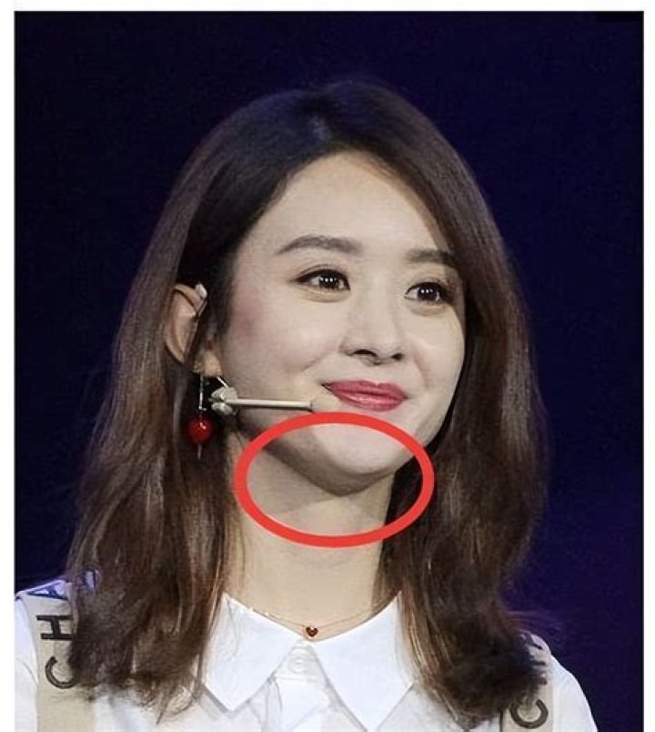 How do celebrities not have double chins?