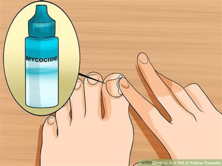 How do you get rid of yellow toenails?