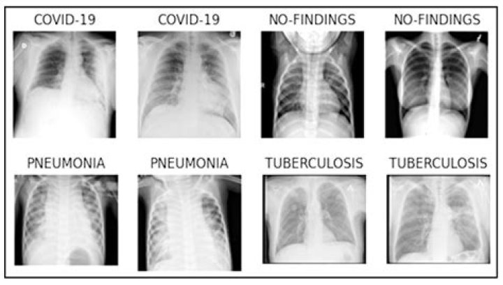 How do you know you have pneumonia COVID?