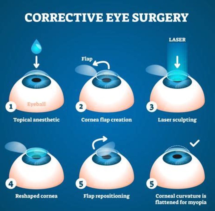 Which surgery is best for high myopia?