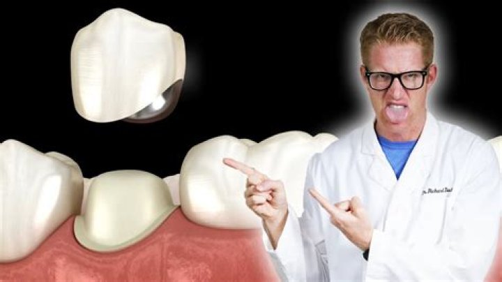 Why do dentist look at your tongue?